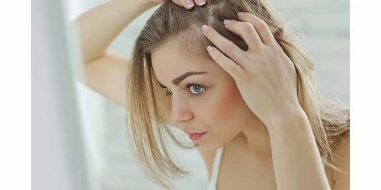 How To Get Rid Of Dandruff