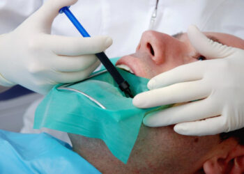 What You Should Know About Root Canal Before And After Your Procedure