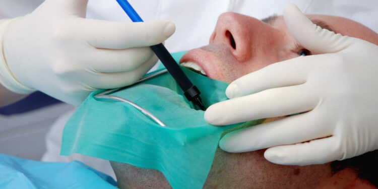 What You Should Know About Root Canal Before And After Your Procedure