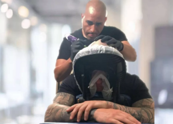 Who Is The Best Candidate for Scalp Micropigmentation?