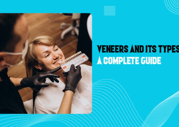 Veneers and its Types - A Complete Guide