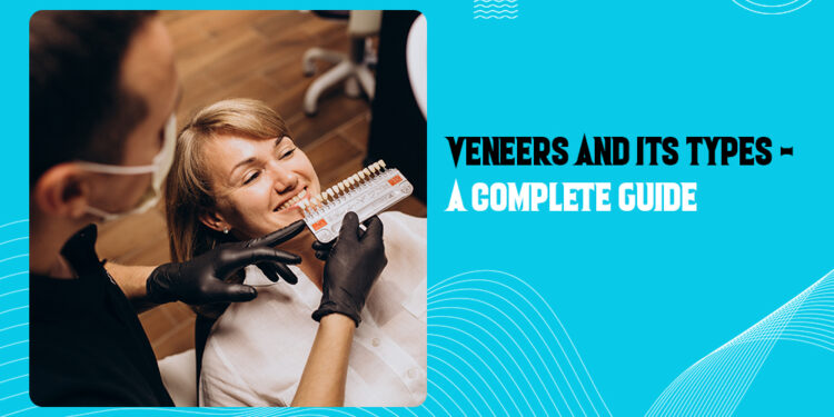 Veneers and its Types - A Complete Guide