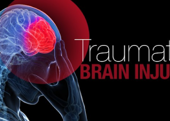 Traumatic Brain Injury – Important Things You Need to Know