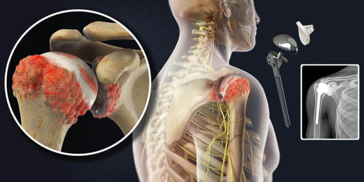 best orthopedic doctor in jaipur